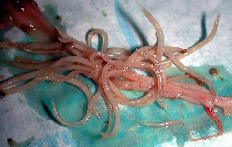 Verminosi intestinale